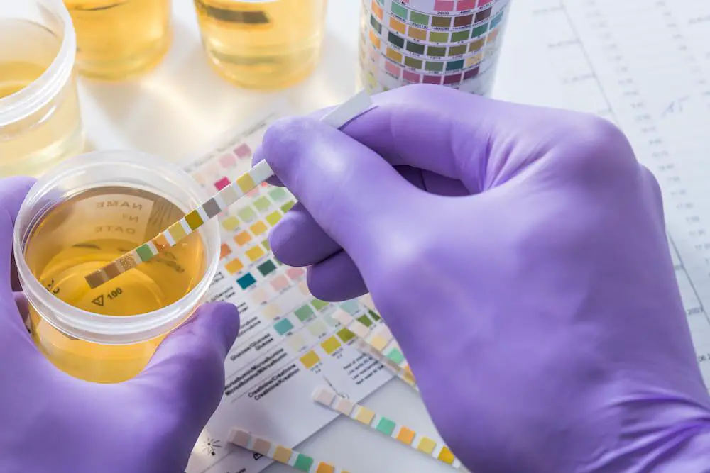 Dreiekiges Schild mit rotem Rand mit Schriftzug EHEC kroger drug test